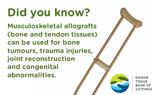 Did you know - musculoskeletal fact.